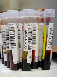 samples of human blood collected for testing (image courtesy: Wikimedia Commons)