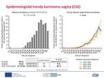 Epidemiologické trendy karcinomu vaginy (C52): věková struktura